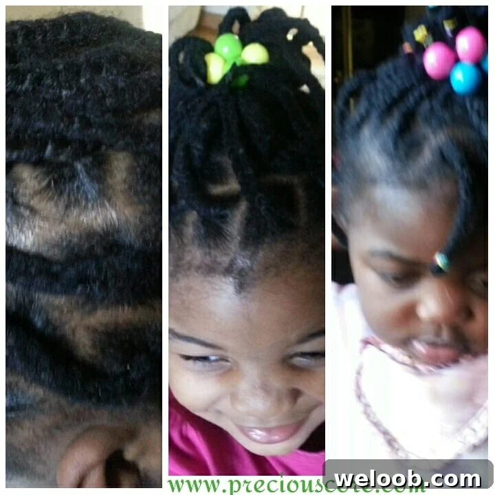 After braids